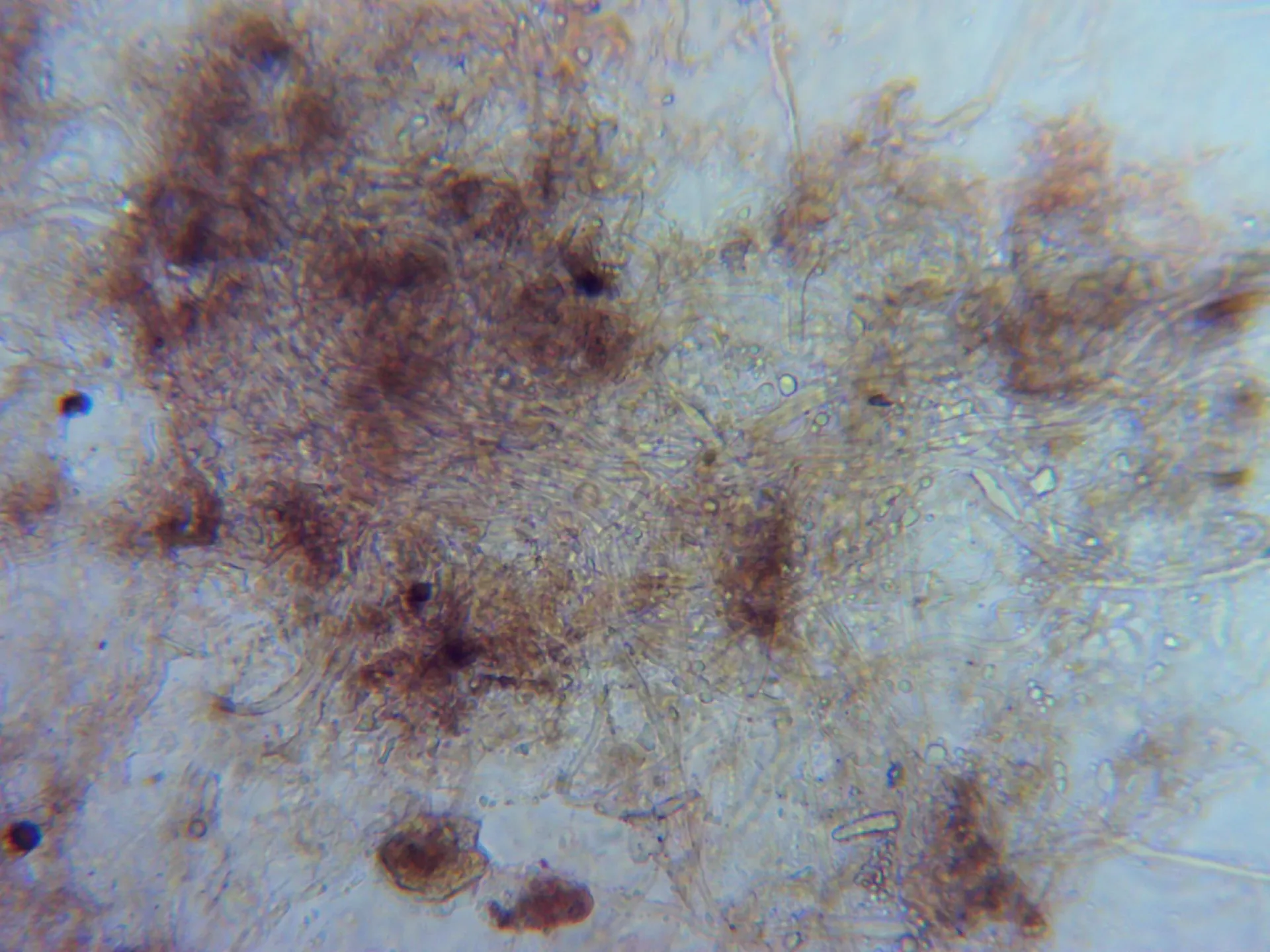 Microscopía de Hohenbuehelia nigra - 10 - Pileipellis elástica x 400